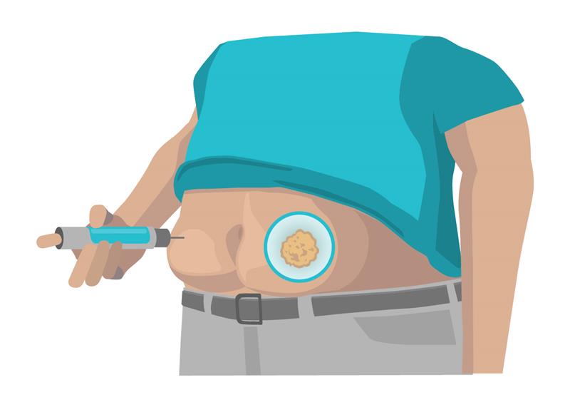 6.3.1+6.3.2 Injection on the abdomen 1