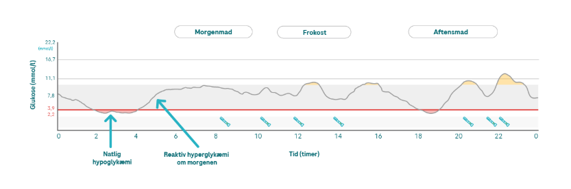 6.3.1. Somogyi effect mmol_G