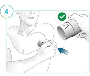 : Illustration af trin 4: En person, der bruger applikatoren til at indsætte CGM på det forberedte påføringssted.