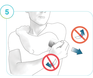 Illustration af trin 5: Retningen for at fjerne applikatoren fra påføringsstedet.